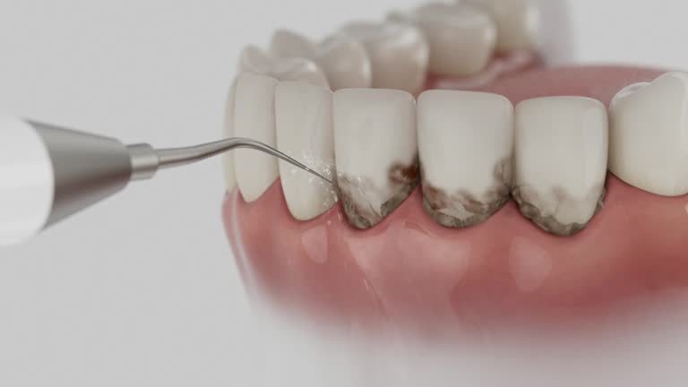 Reliable Dental contractor in Pierce, CO by Dentist Open Now